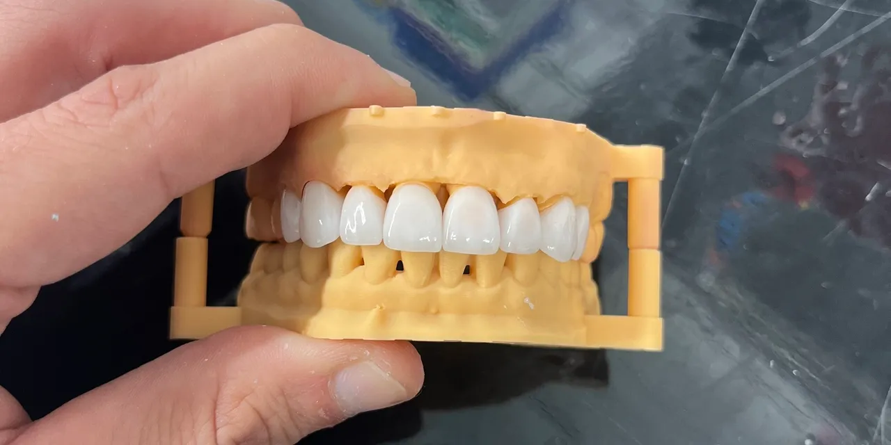 Dental model depicting human teeth anatomy.