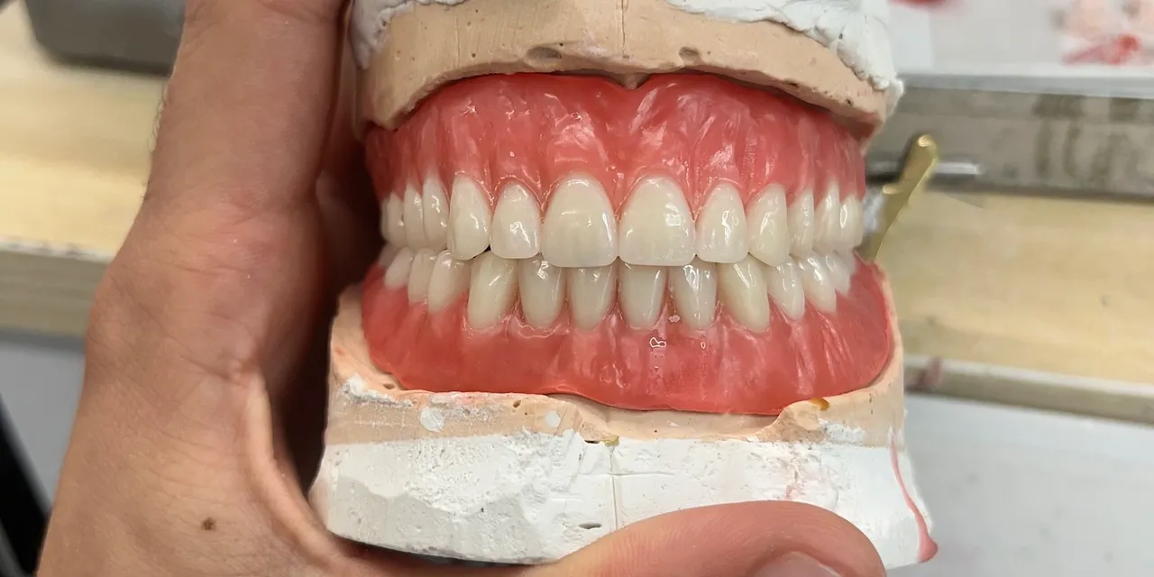 Dental model showing upper and lower teeth.