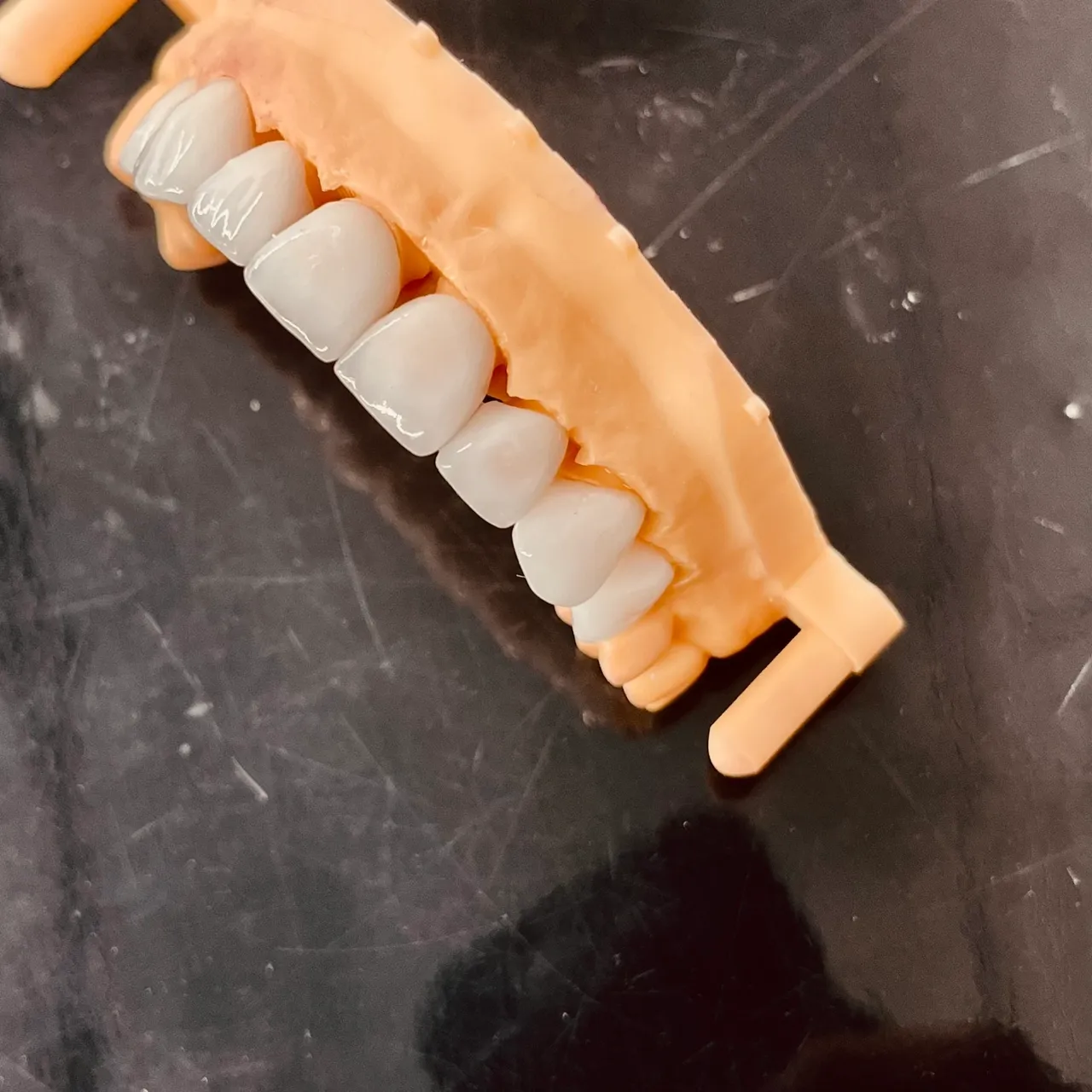 Dental model showing human teeth arrangement.