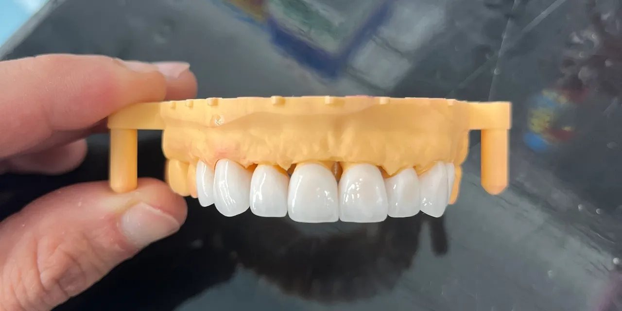 Dental model with white teeth on display.